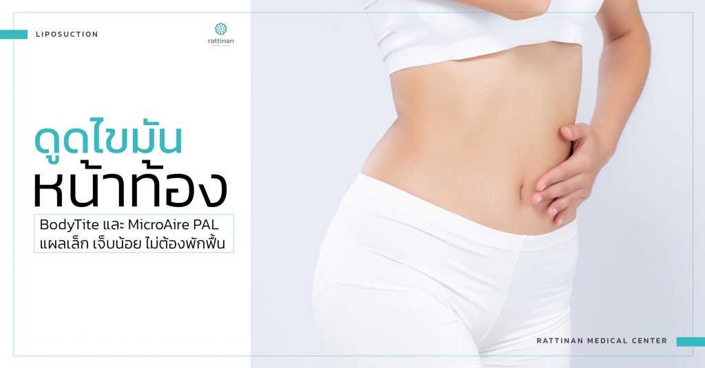 belly liposuction service