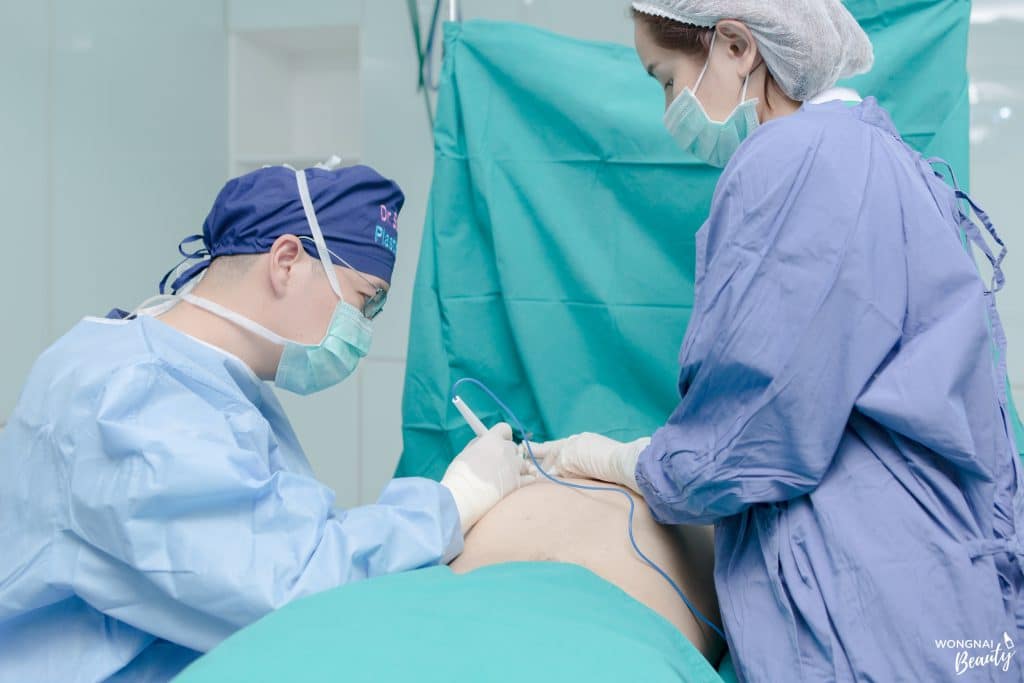 gynecomastia surgery