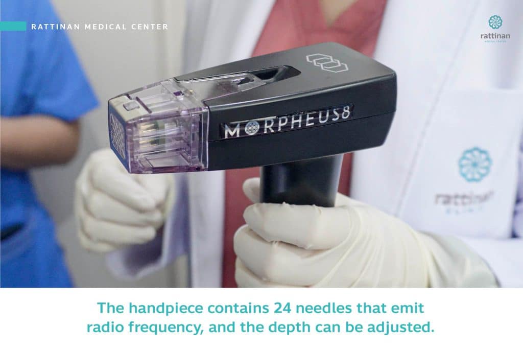 Morpheus 8 The handpiece contains 24 needles that emit radio frequency, and the depth can be adjusted.