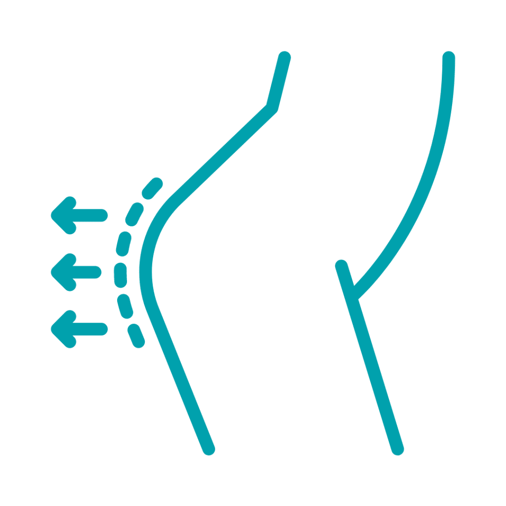 Buttock Augmentation FAQs