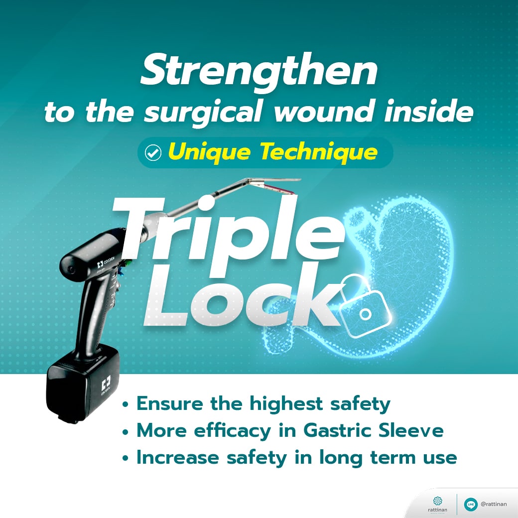 Triple lock