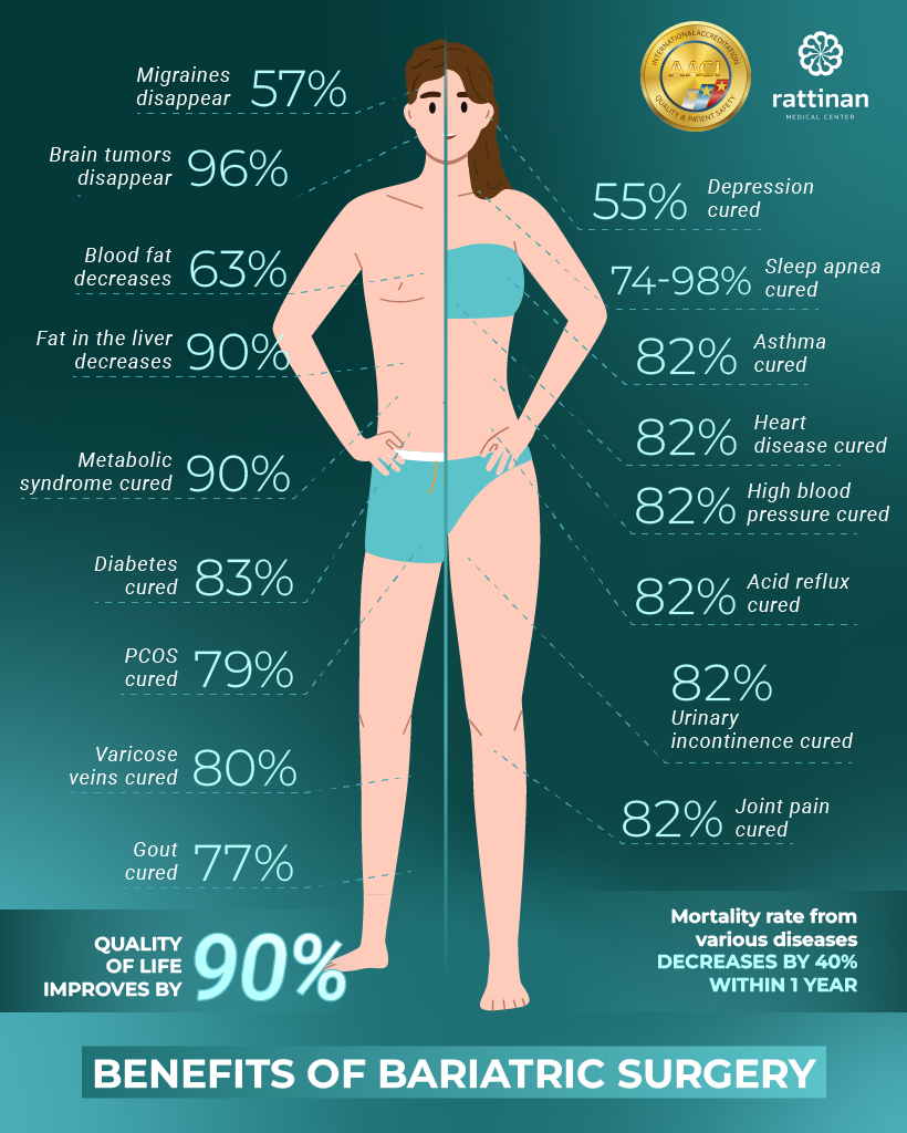 Bariatric Surgery FAQs