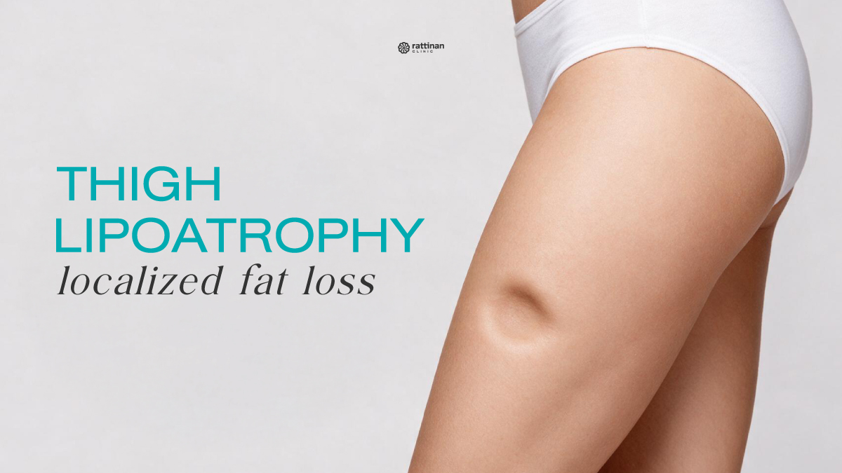 Thigh Lipoatrophy