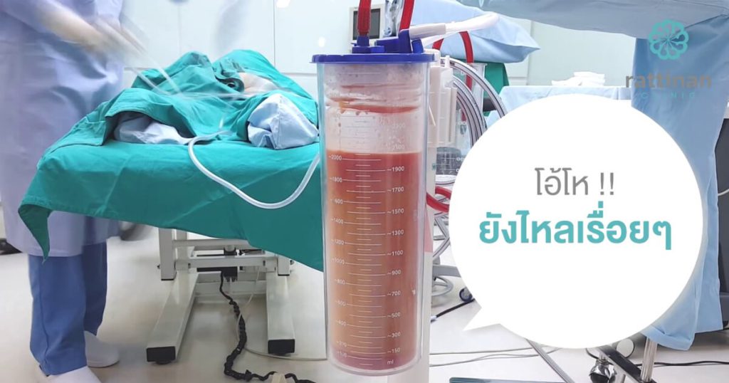 ดูดไขมันต้นขา ไม่จำกัดซีซี