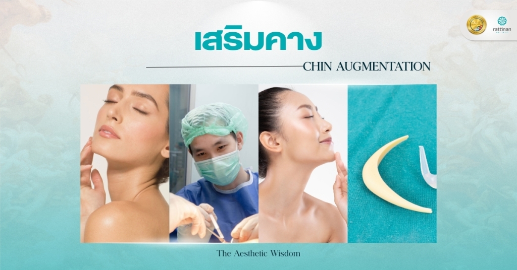 เสริมคาง