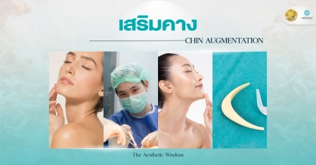 เสริมคาง