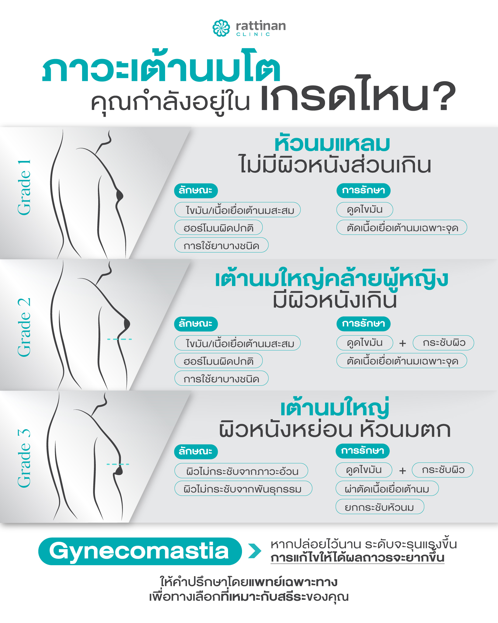 อาการ Gynecomastia มีกี่เกรด กี่ระดับ