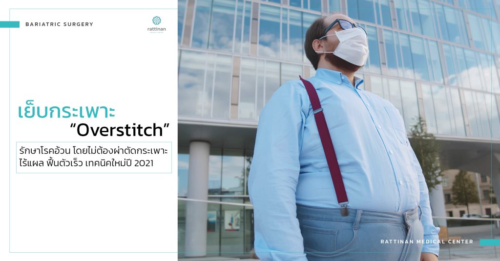 เย็บกระเพาะ overstitch เทคนิคใหม่ ไร้แผลหน้าท้อง