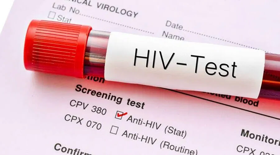 ทดสอบ เอดส์ HIV