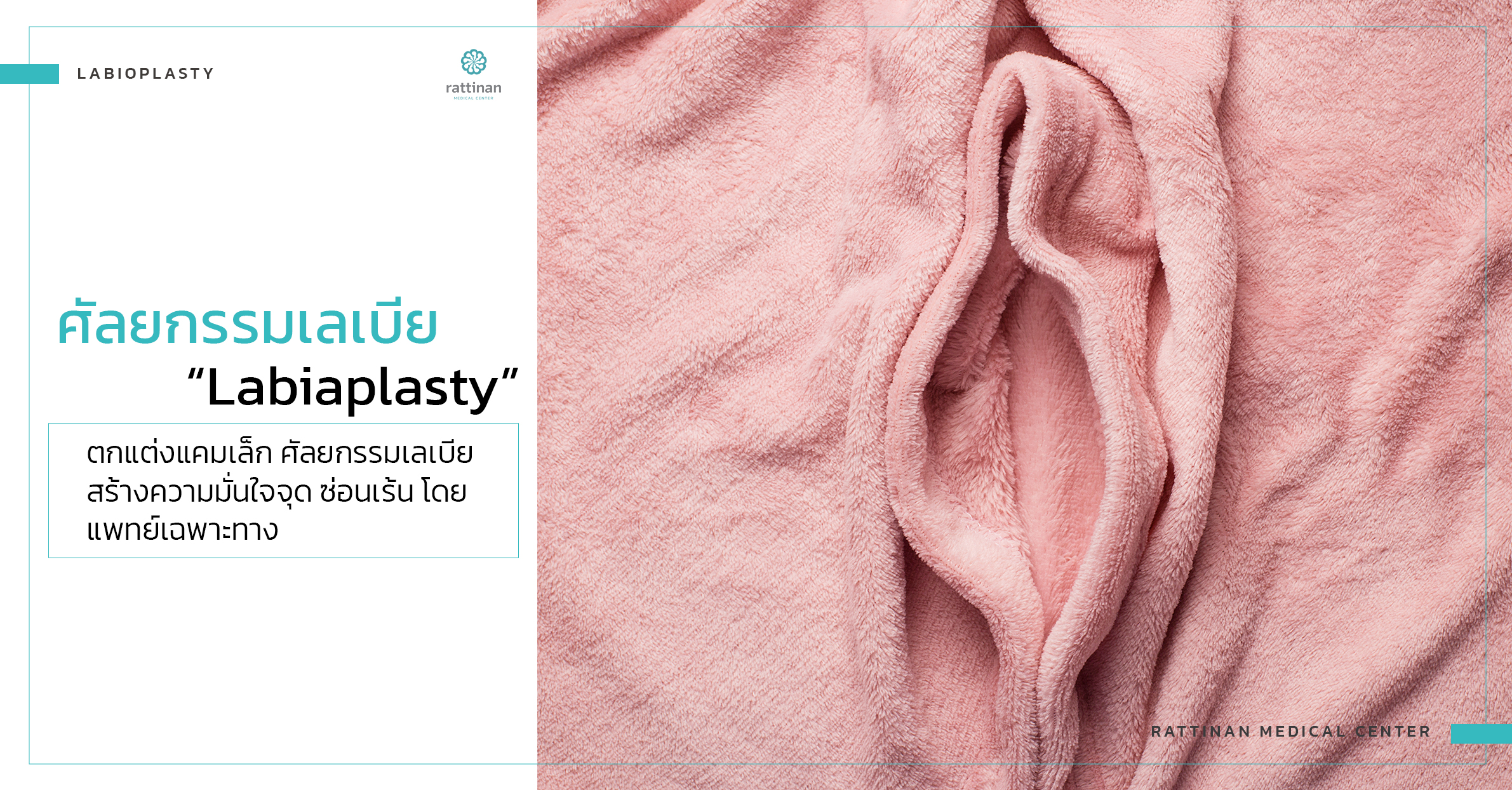 ตกแต่งแคมเล็ก ศัลยกรรมเลเบีย (Labiaplasty)