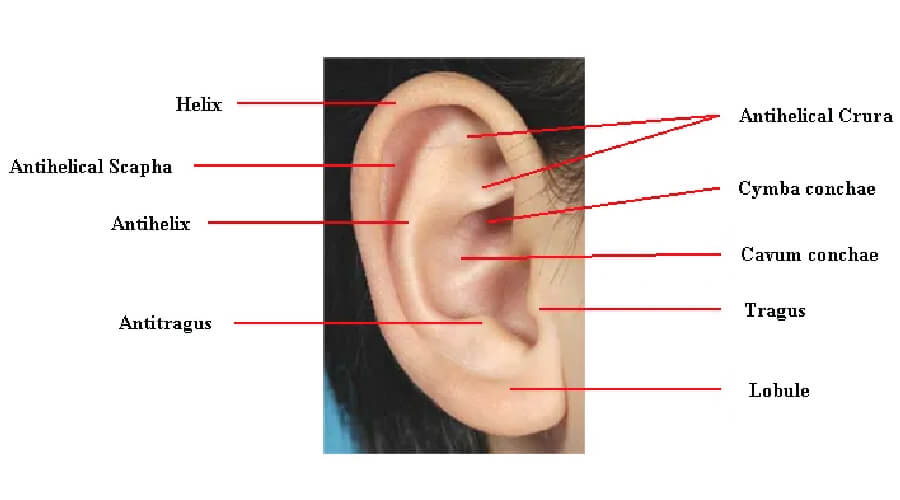 ศัลยกรรมหูกาง otoplasty