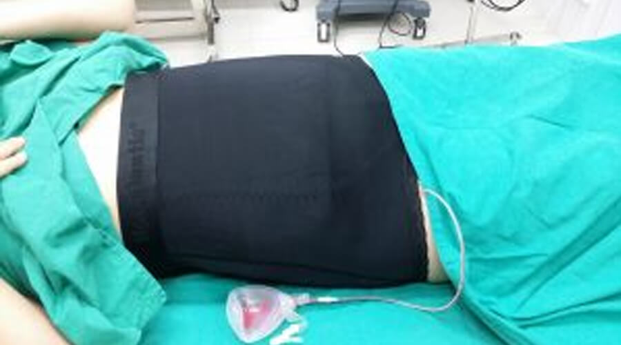 ทำไมต้องใส่ ชุดกระชับหลังดูดไขมัน