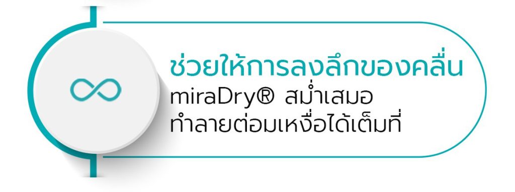 การลงลึกของคลื่น miraDry ทำลายต่อมเหงื่อได้เต็มประสิทธิภาพ