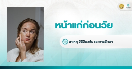 หน้าแก่ก่อนวัย