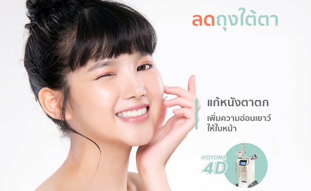 ถุงใต้ตา รักษาด้วยเลเซอร์ Fotona 4D