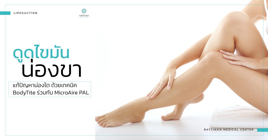 ดูดไขมันน่อง bodyTite + microAire PAL