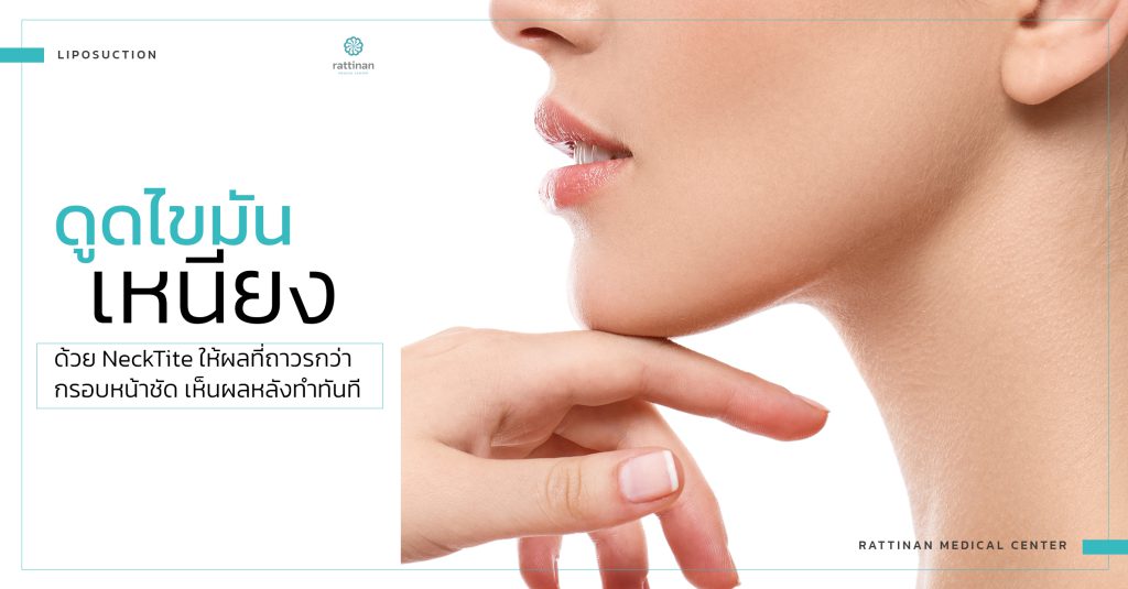 ดูดไขมันเหนียง bodyTite + microAire PAL