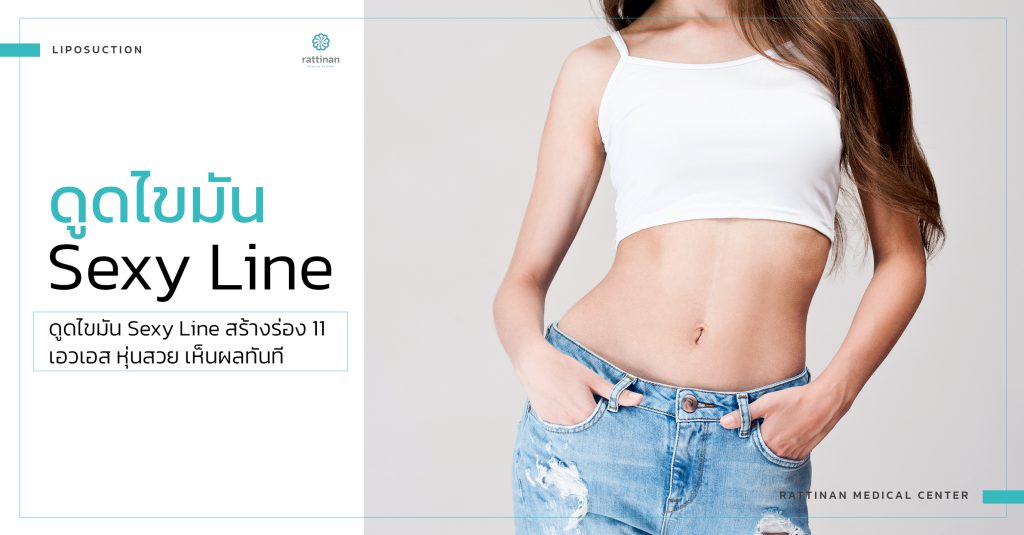 ดูดไขมันเซ็กซี่ไลน์ bodyTite + microAire PAL sexyline