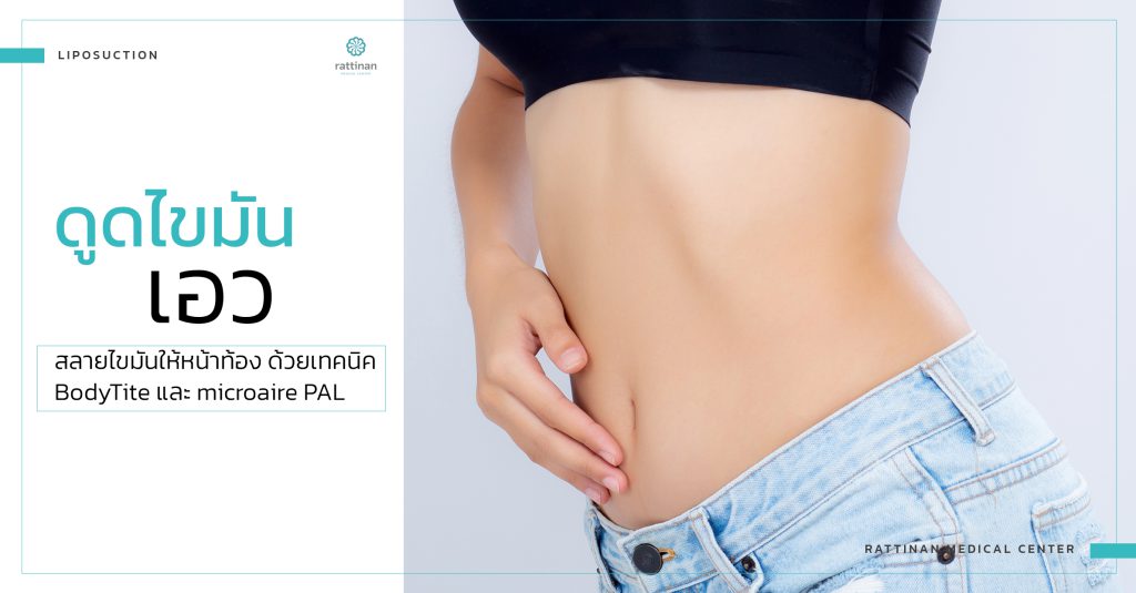 ดูดไขมันเอว bodyTite + microAire PAL