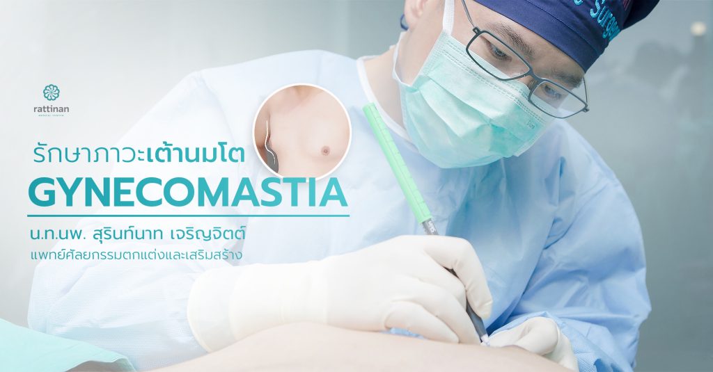 รักษาภาวะเต้านมโตในผู้ชาย gynecomastia
