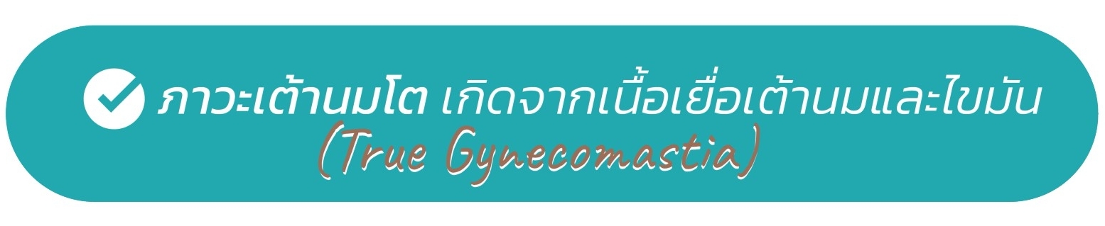 ภาวะเต้านมโต เกิดจากเนื้อเยื่อเต้านมและไขมัน (True Gynecomastia)