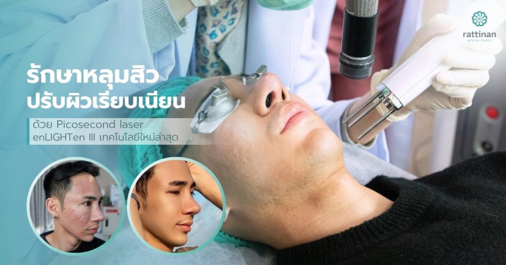 รักษาหลุมสิว ด้วย Pico Laser