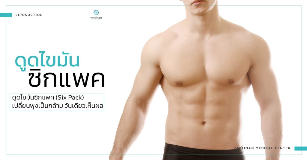 ดูดไขมันซิกแพค Six Pack ที่ รัตตินันท์ เมดิคอล เซ็นเตอร์