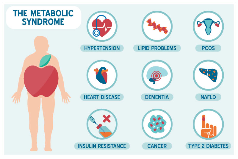 อาการของอ้วนลงพุง (Metabolic Syndrome)
