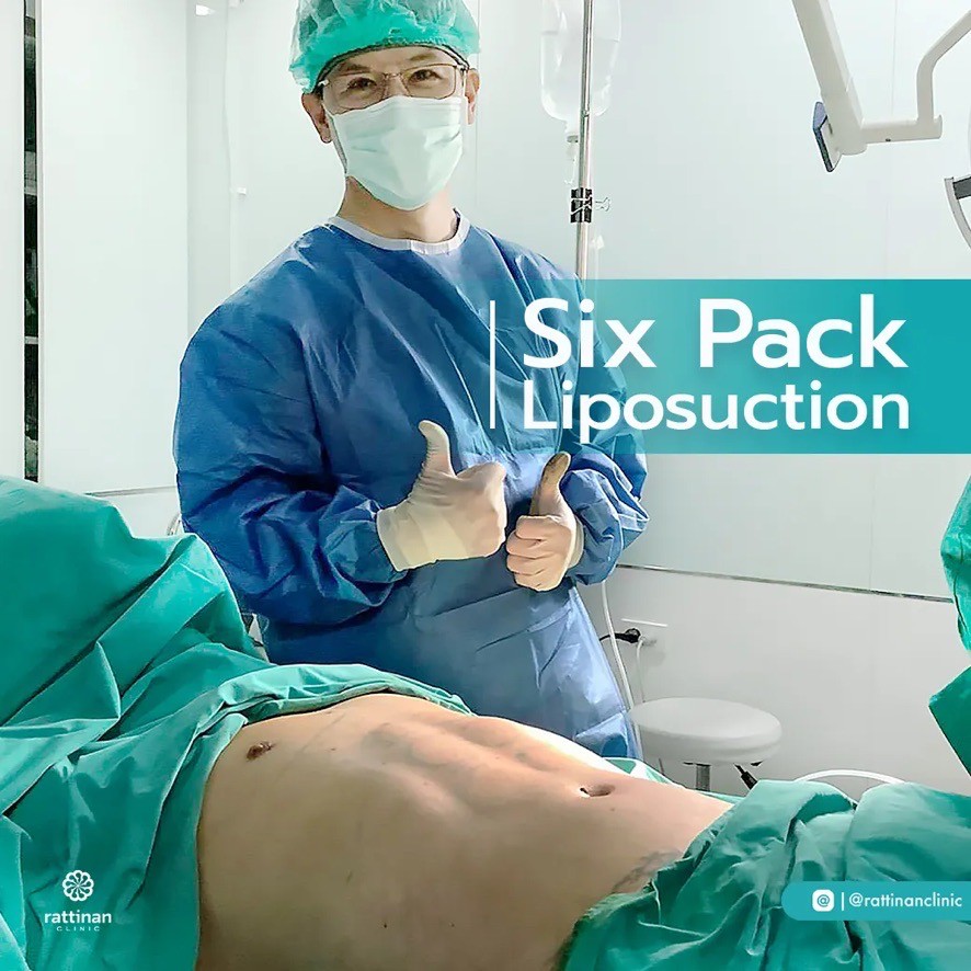 ดูดไขมัน สร้าง six pack โดย นพ.สุทธิพงษ์ ที่รัตตินันท์ เมดิคอล เซ็นเตอร์