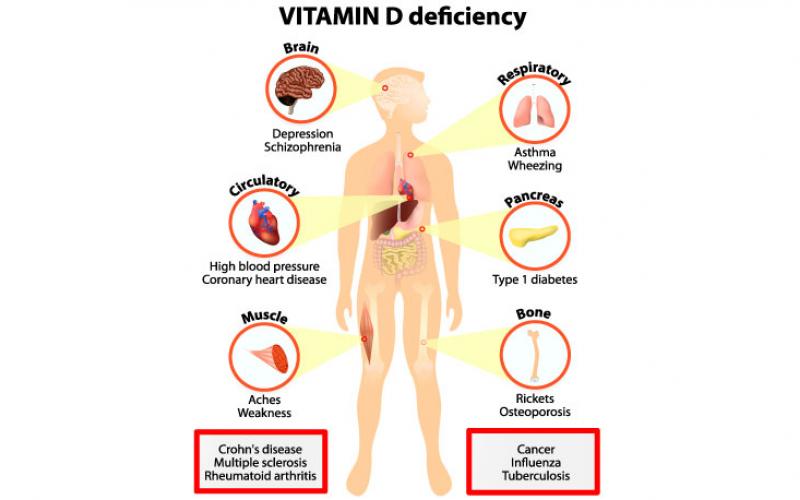 ความสำคัญของ วิตามินดี ต่อระะบบการทำงานของอวัยวะในร่างกาย