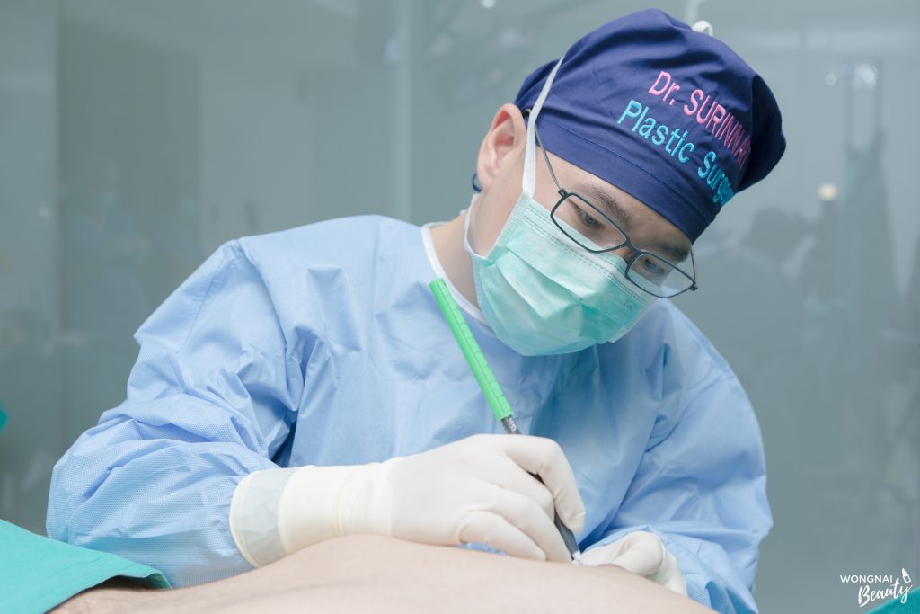 เต้านมโตในผู้ชาย (gynecomastia) ที่รัตตินันท์ เมดิคอล เซ็นเตอร์