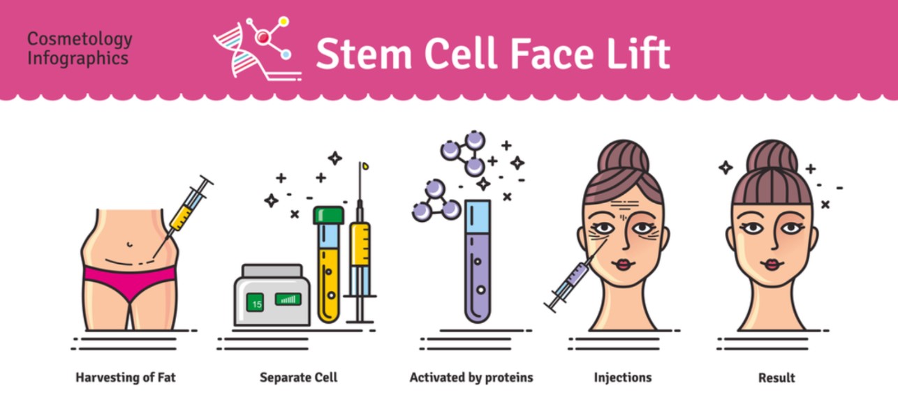 stem cells - เสต็มเซลล์ ฉีดหน้า ชะลอวัย ลดริ้วรอย