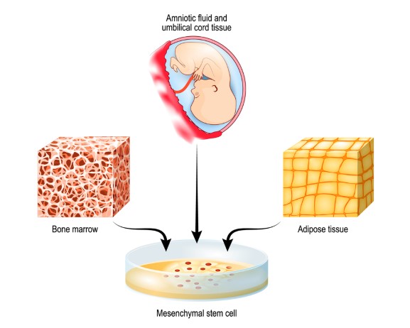 stem cells คืออะไร มาจากแหล่งไหนบ้าง