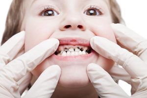 อาการ ฟันผุ เกิดจากอะไร