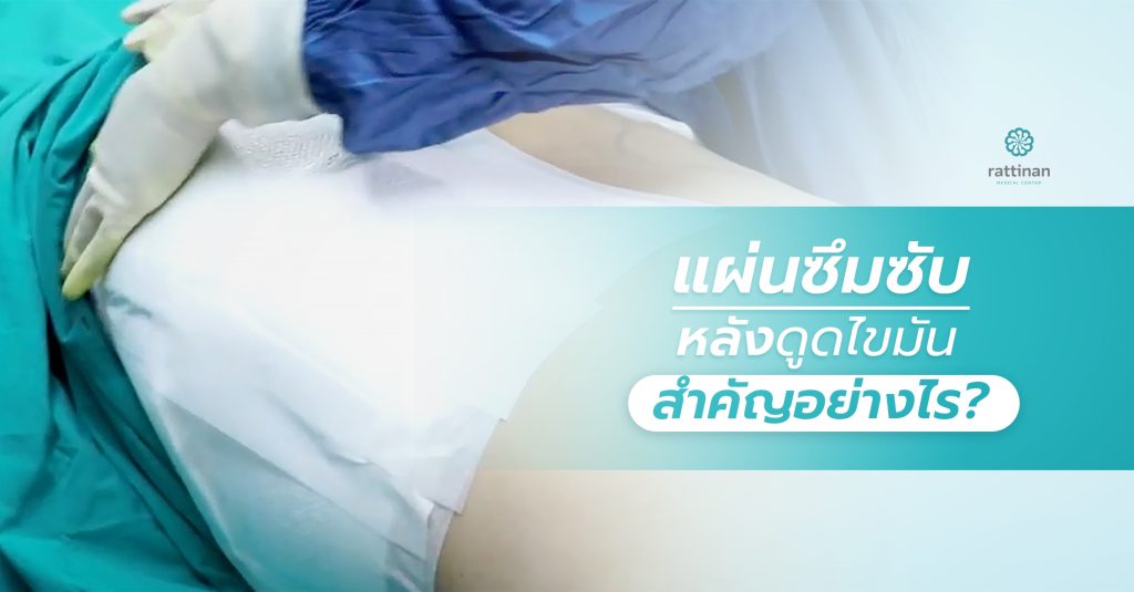 แผ่นซึมซับหลังดูดไขมัน สำคัญอย่างไร