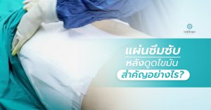 แผ่นซึมซับหลังดูดไขมัน สำคัญอย่างไร