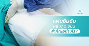 แผ่นซึมซับหลังดูดไขมัน สำคัญอย่างไร