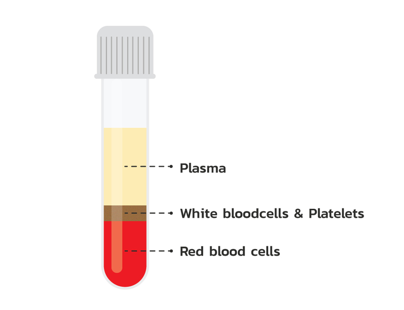 โรคเบาหวาน แผลกดทับ แผลเรื้องรัง รักษาด้วย PRP Therapy