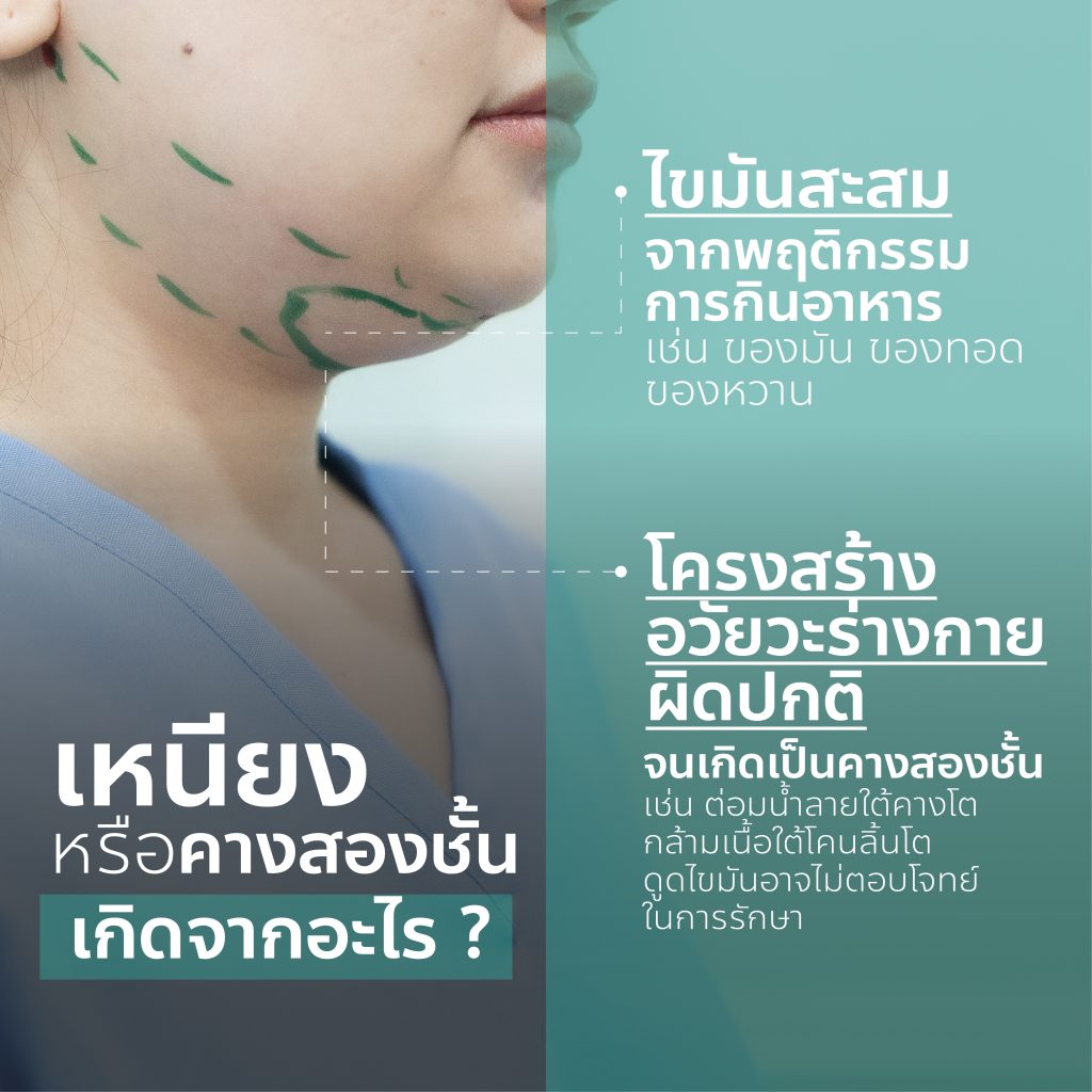 เหนียง หรือ ไขมันใต้คาง เกิดจากอะไร