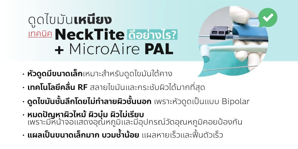 ดูดไขมันเหนียง เทคนิคใหม่ NeckTite ดีอย่างไร