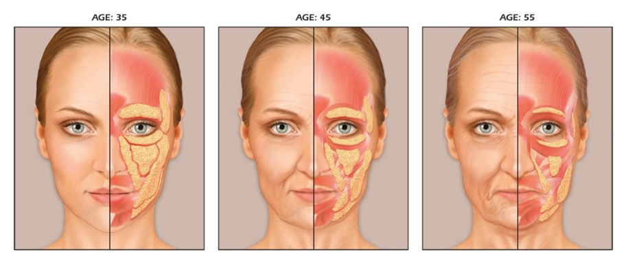 ศัลยกรรมหน้าเด็ก Face Lift ผ่าตัดดึงหน้า