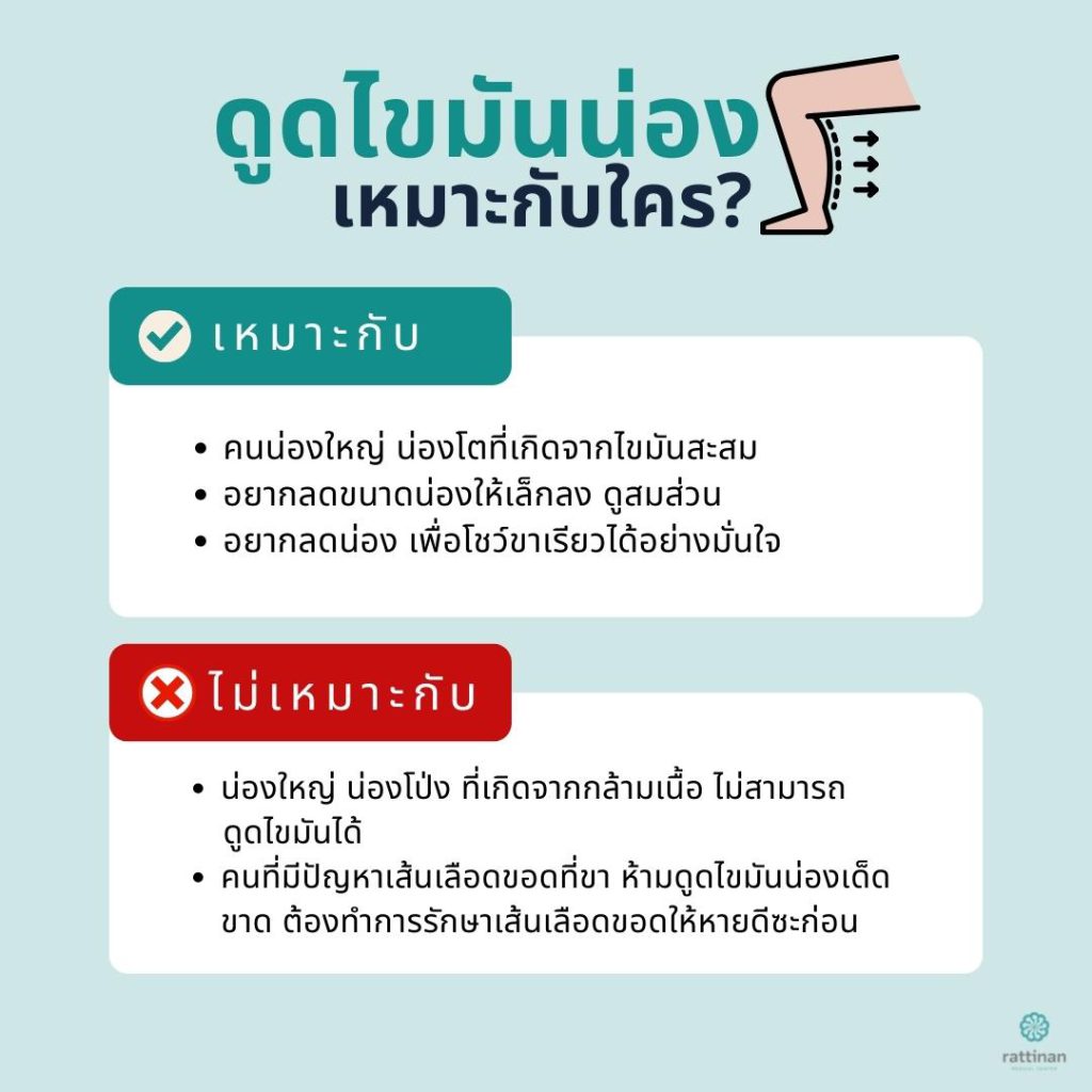 ดูดไขมัน่น่อง เหมาะกับใคร