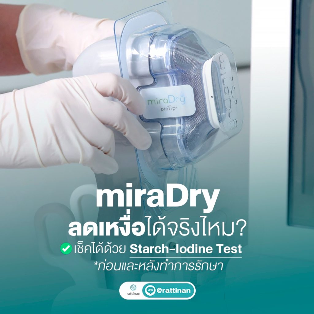 miraDry ลดเหลื่อ ลดกลิ่นตัว