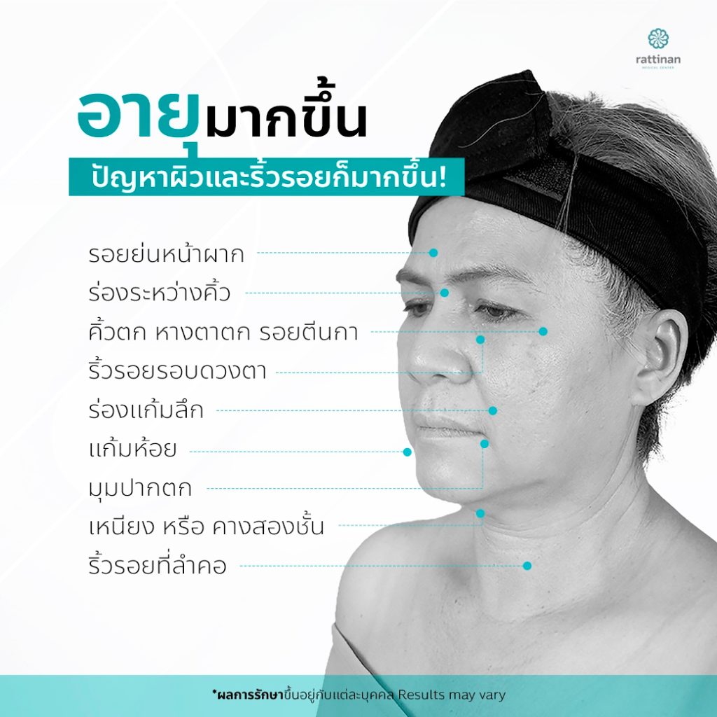 ทำไมต้อง ศัลยกรรมดึงหน้า ผ่าตัดดึงหน้า