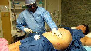 Smart Lipo เวลาทำต้องใส่แว่นกันแสงเลเซอร์เข้าตาด้วย