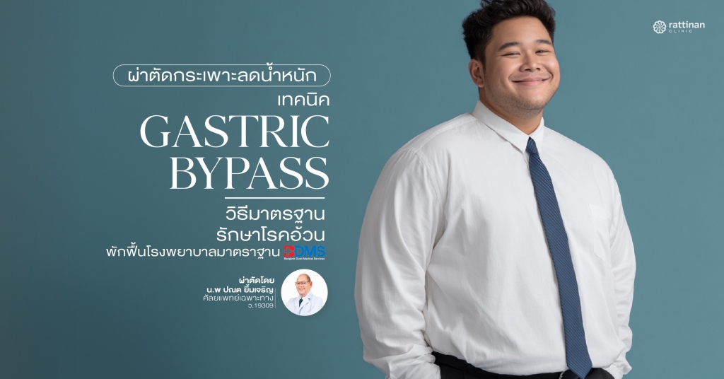 ผ่าตัดกระเพาะลดน้ำหนักแบบบายพาส (Gastric Bypass) วิธีมาตรฐานรักษาโรคอ้วน