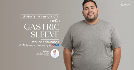ผ่าตัดกระเพาะแบบสลีฟ (Gastric Sleeve) ด้วยการส่องกล้อง แผลเล็ก!