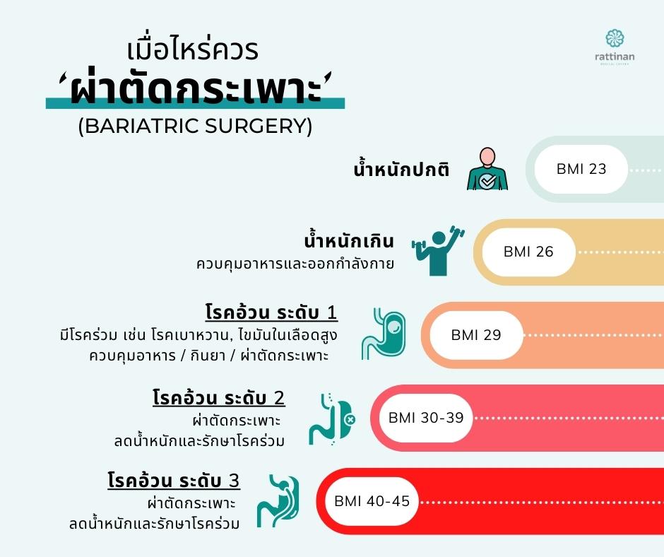 ควร ผ่าตัดกระเพาะ เมื่อไหร่