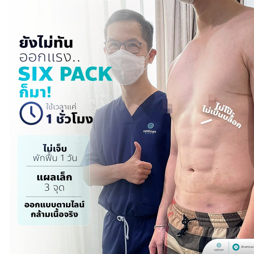 ดูดไขมันซิกแพค six pack liposuction