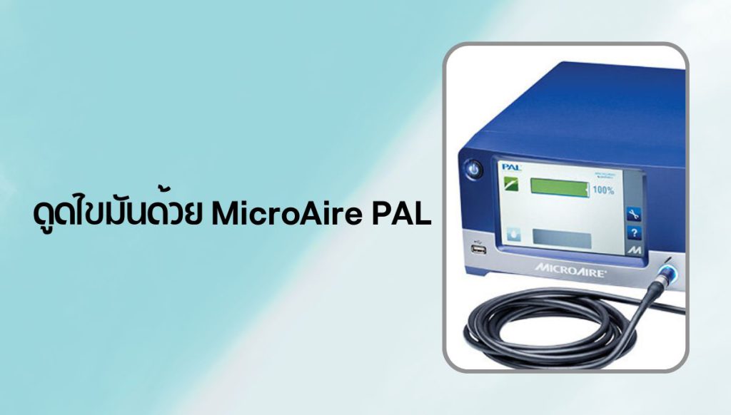 ดูดไขมันแบบไหนดี MicroAire PAL